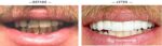 Four Ever Smile Dental Implant Center